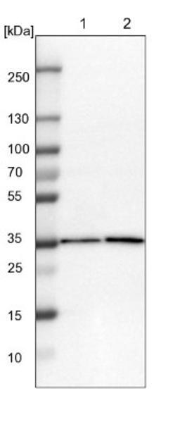 Western Blot: ZBTB37 Antibody [NBP1-81151] - Lane 1: NIH-3T3 cell lysate (Mouse embryonic fibroblast cells)<br/>Lane 2: NBT-II cell lysate (Rat Wistar bladder tumour cells)