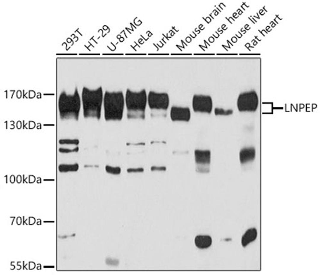 Western blot - LNPEP antibody (A11959)