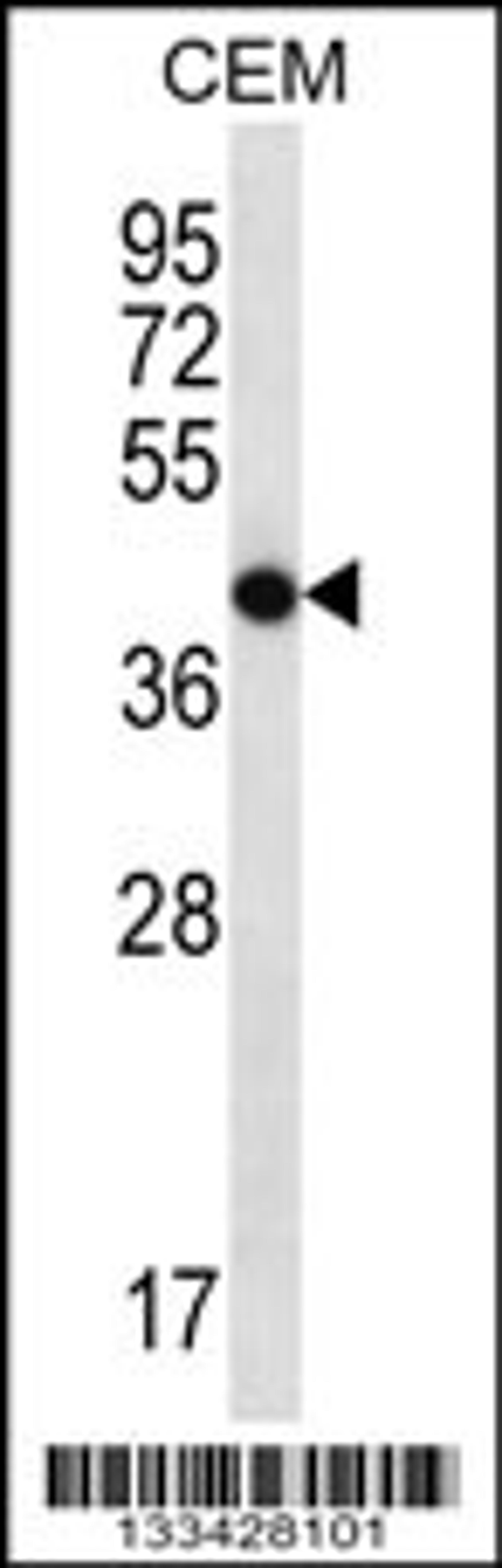 Western blot analysis in CEM cell line lysates (35ug/lane).