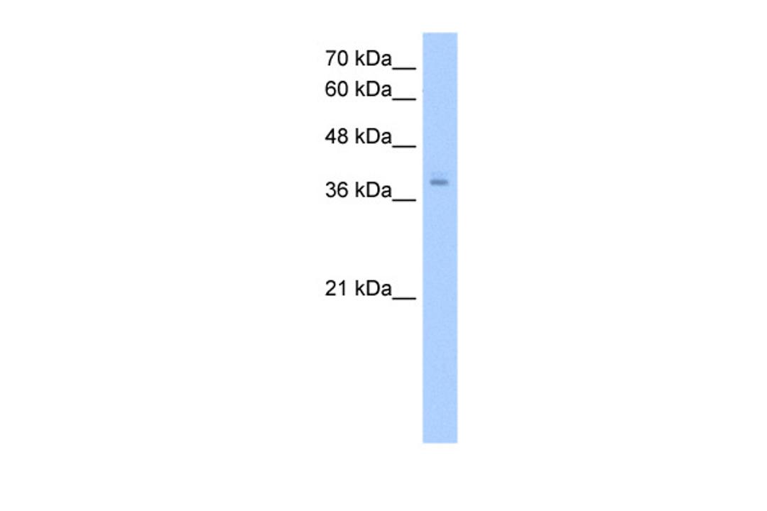 Antibody used in WB on Human HepG2 at 2.5 ug/ml.