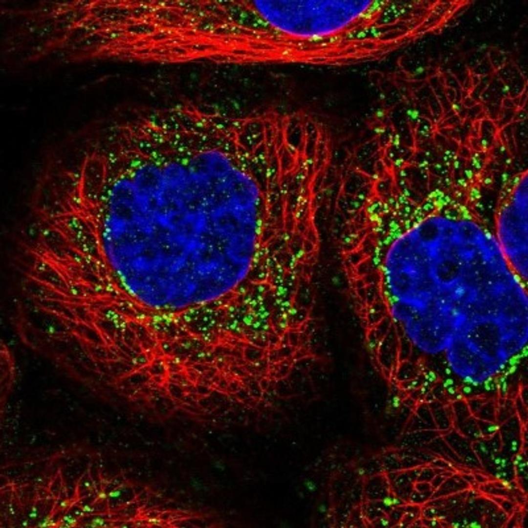 Immunocytochemistry/Immunofluorescence: MLC1SA Antibody [NBP1-92124] - Staining of human cell line A-431 shows positivity in vesicles.