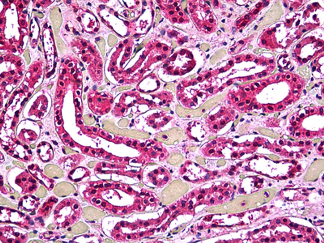 Immunohistochemistry of human kidney tubules stained using Acid Phosphatase 2 Monoclonal Antibody.