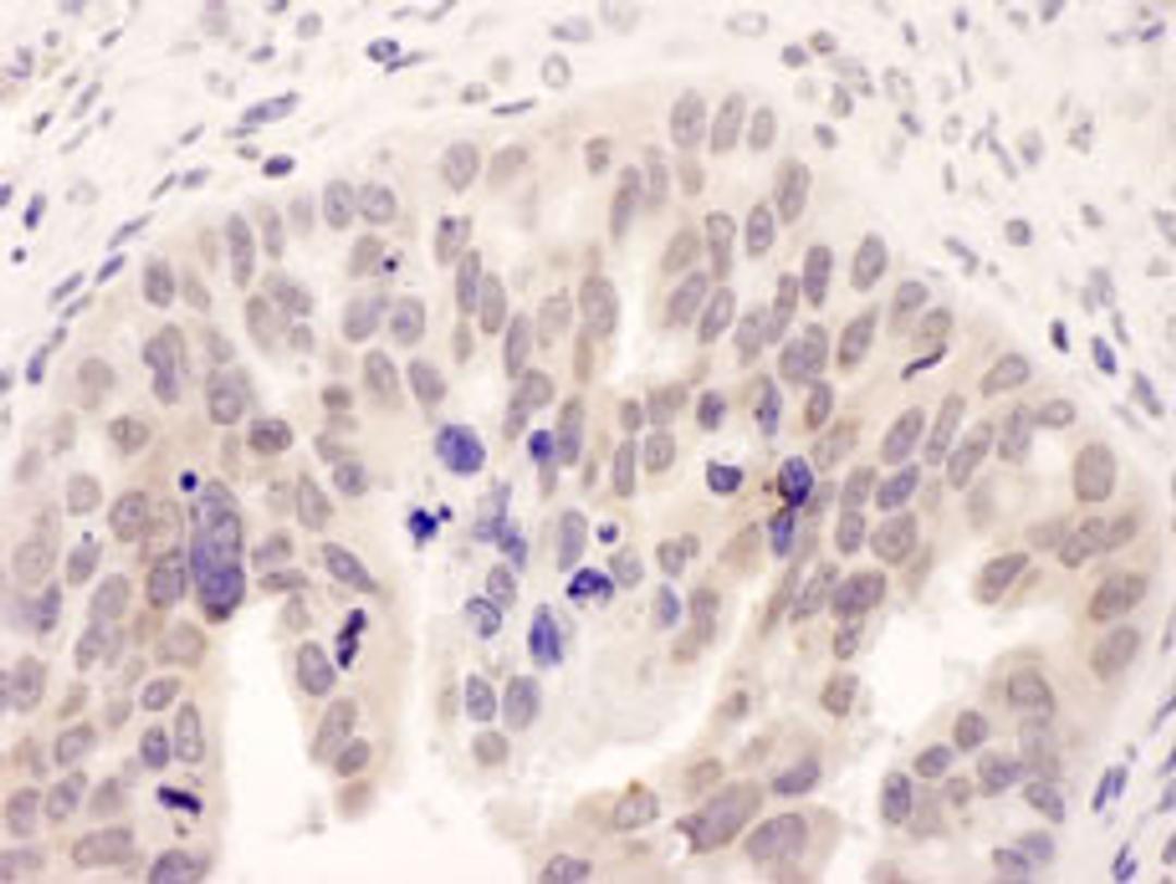 Detection of human NMI by immunohistochemistry.