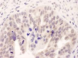 Detection of human NMI by immunohistochemistry.