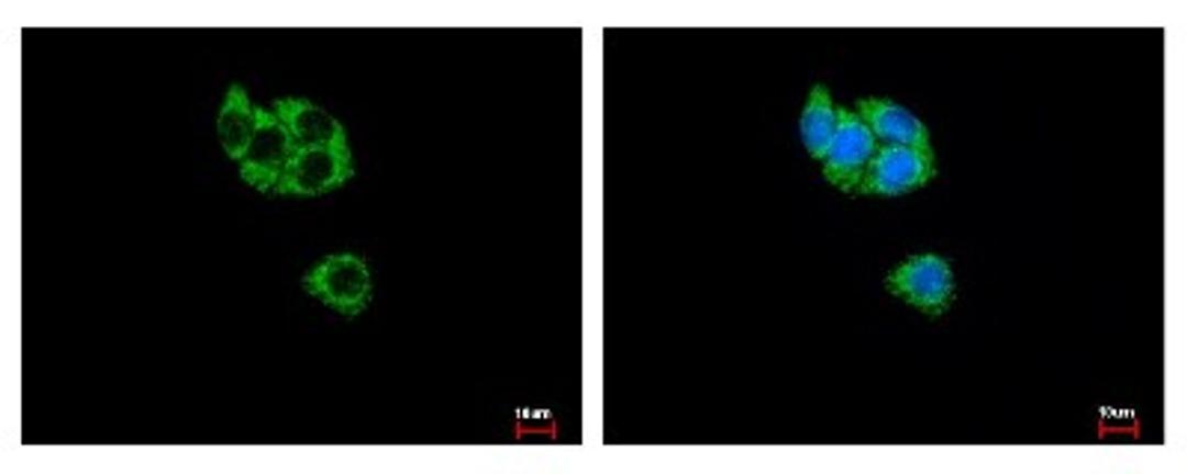 Immunocytochemistry/Immunofluorescence: GCDH Antibody [NBP2-16622] - HepG2 cells were fixed in -20C 100% MeOH for 5 min. Green: GCDH protein stained by GCDH antibody diluted at 1:500. Blue: Hoechst 33343 staining.