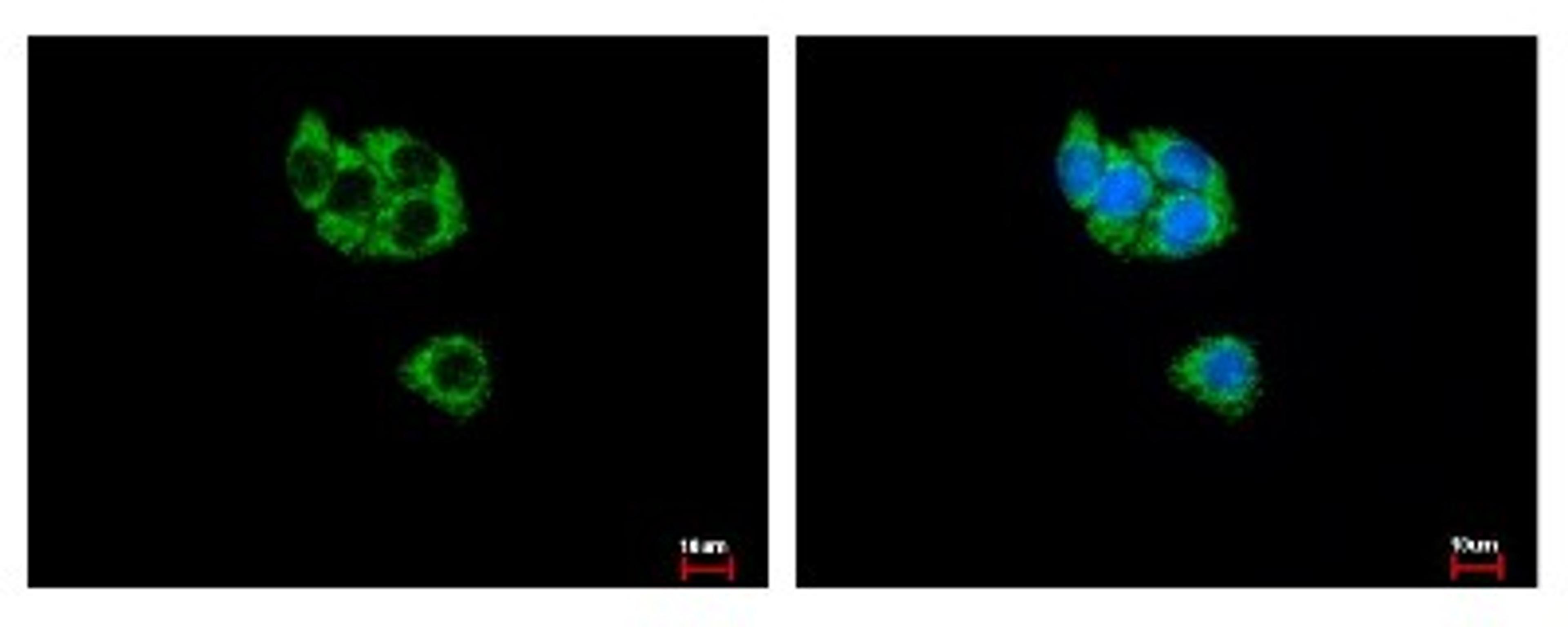 Immunocytochemistry/Immunofluorescence: GCDH Antibody [NBP2-16622] - HepG2 cells were fixed in -20C 100% MeOH for 5 min. Green: GCDH protein stained by GCDH antibody diluted at 1:500. Blue: Hoechst 33343 staining.