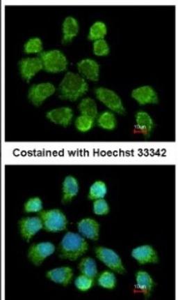 Immunocytochemistry/Immunofluorescence: GSTZ1 Antibody [NBP1-33693] - Analysis of methanol-fixed A431, using antibody at 1:200 dilution.