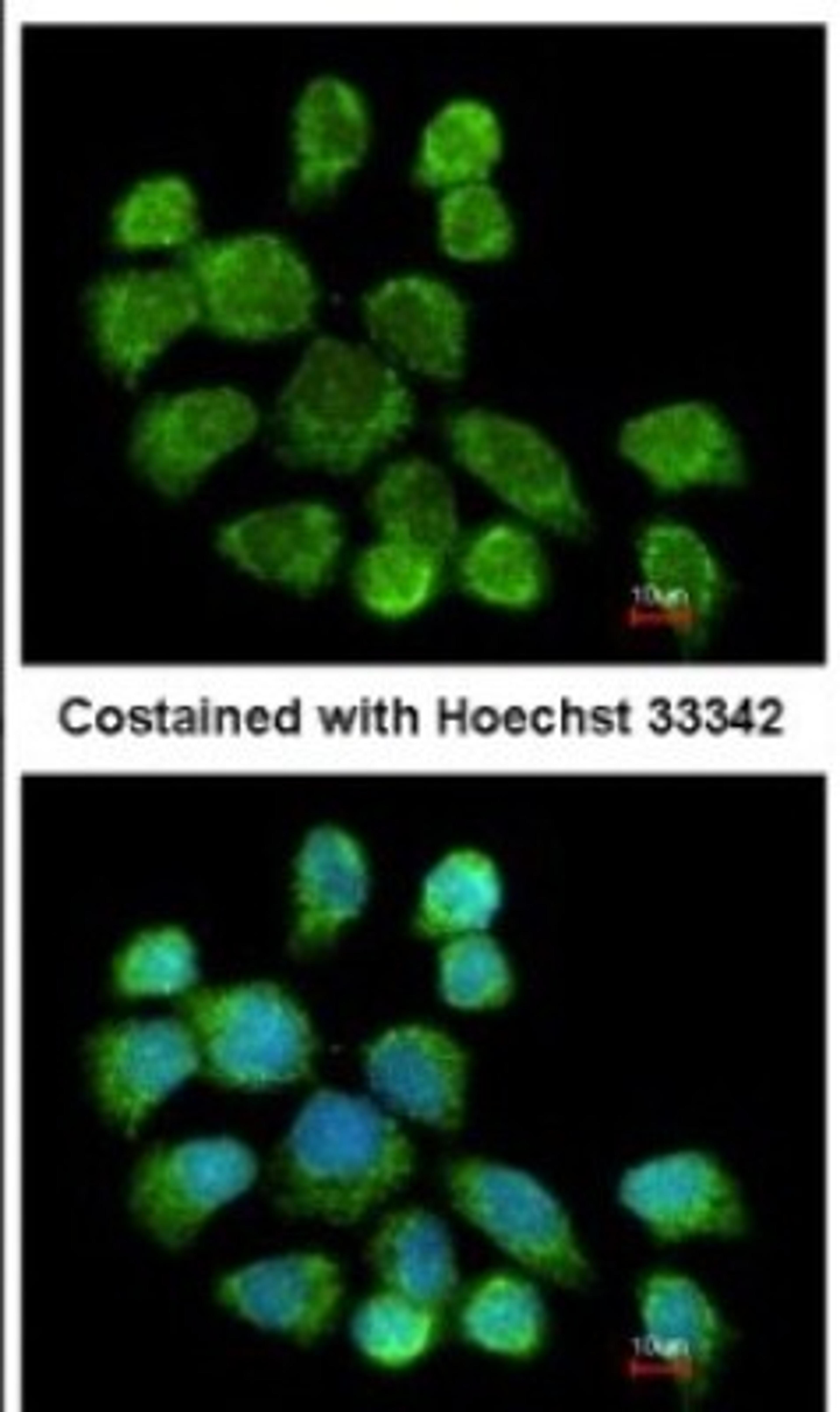 Immunocytochemistry/Immunofluorescence: GSTZ1 Antibody [NBP1-33693] - Analysis of methanol-fixed A431, using antibody at 1:200 dilution.