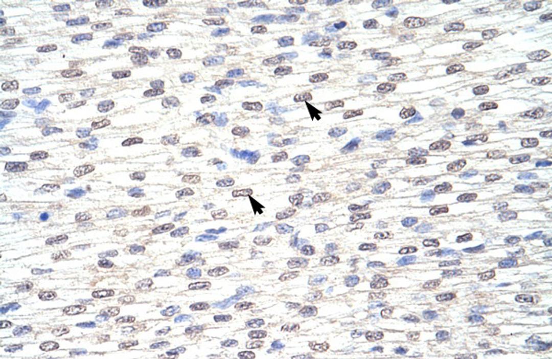 Antibody used in IHC on Human Heart.