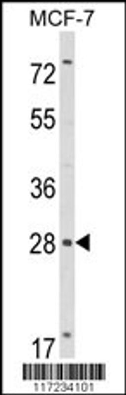 Western blot analysis of RASL11B Antibody in MCF-7 cell line lysates (35ug/lane)