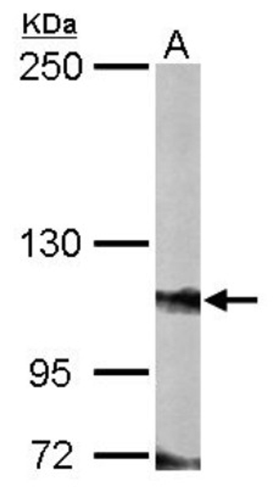 Western Blot: FOG2 Antibody [NBP1-32895] - Sample (50 ug of whole cell lysate) A: Mouse brain 5% SDS PAGE, antibody diluted at 1:3000.