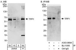 Detection of human TPP1 by western blot and immunoprecipitation.