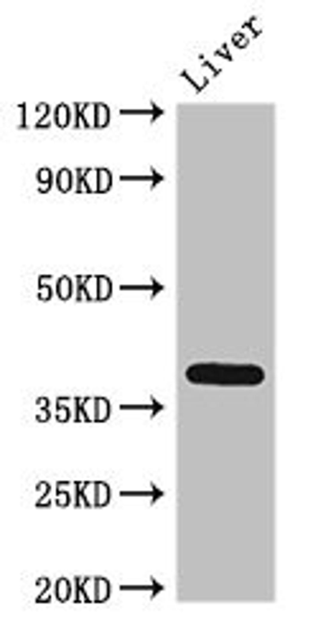 Western Blot. Positive WB detected in: Rat liver tissue. All lanes: ETV7 antibody at 3ug/ml. Secondary. Goat polyclonal to rabbit IgG at 1/50000 dilution. Predicted band size: 39, 33, 31, 37, 30, 23 kDa. Observed band size: 39 kDa.