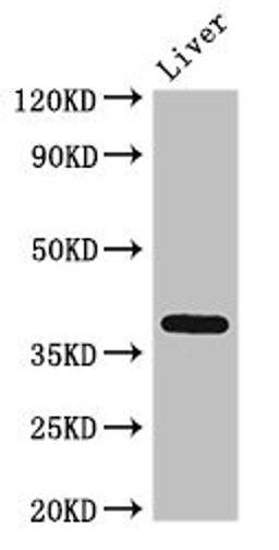 Western Blot. Positive WB detected in: Rat liver tissue. All lanes: ETV7 antibody at 3ug/ml. Secondary. Goat polyclonal to rabbit IgG at 1/50000 dilution. Predicted band size: 39, 33, 31, 37, 30, 23 kDa. Observed band size: 39 kDa.