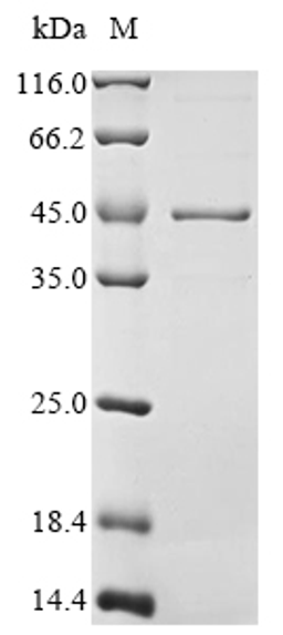 (Tris-Glycine gel) Discontinuous SDS-PAGE (reduced) with 5% enrichment gel and 15% separation gel.