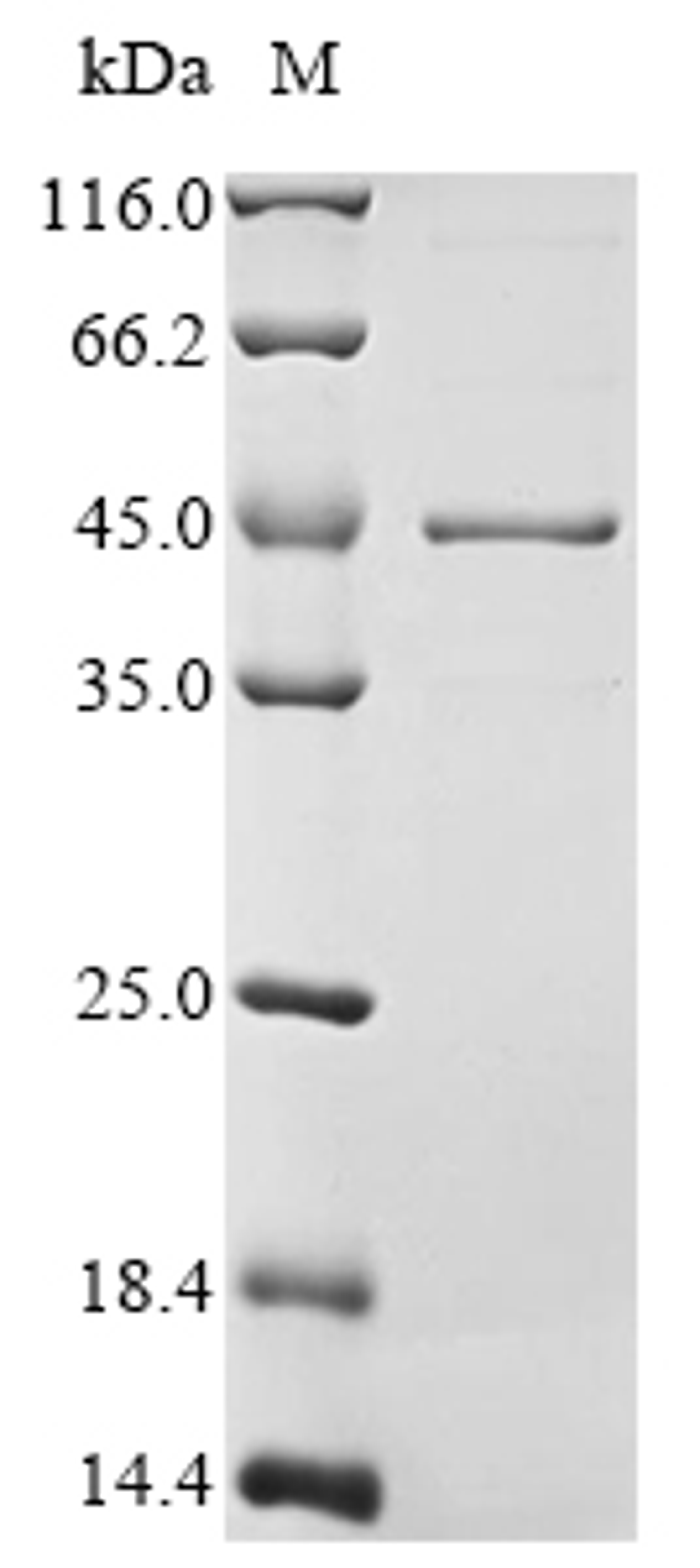 (Tris-Glycine gel) Discontinuous SDS-PAGE (reduced) with 5% enrichment gel and 15% separation gel.
