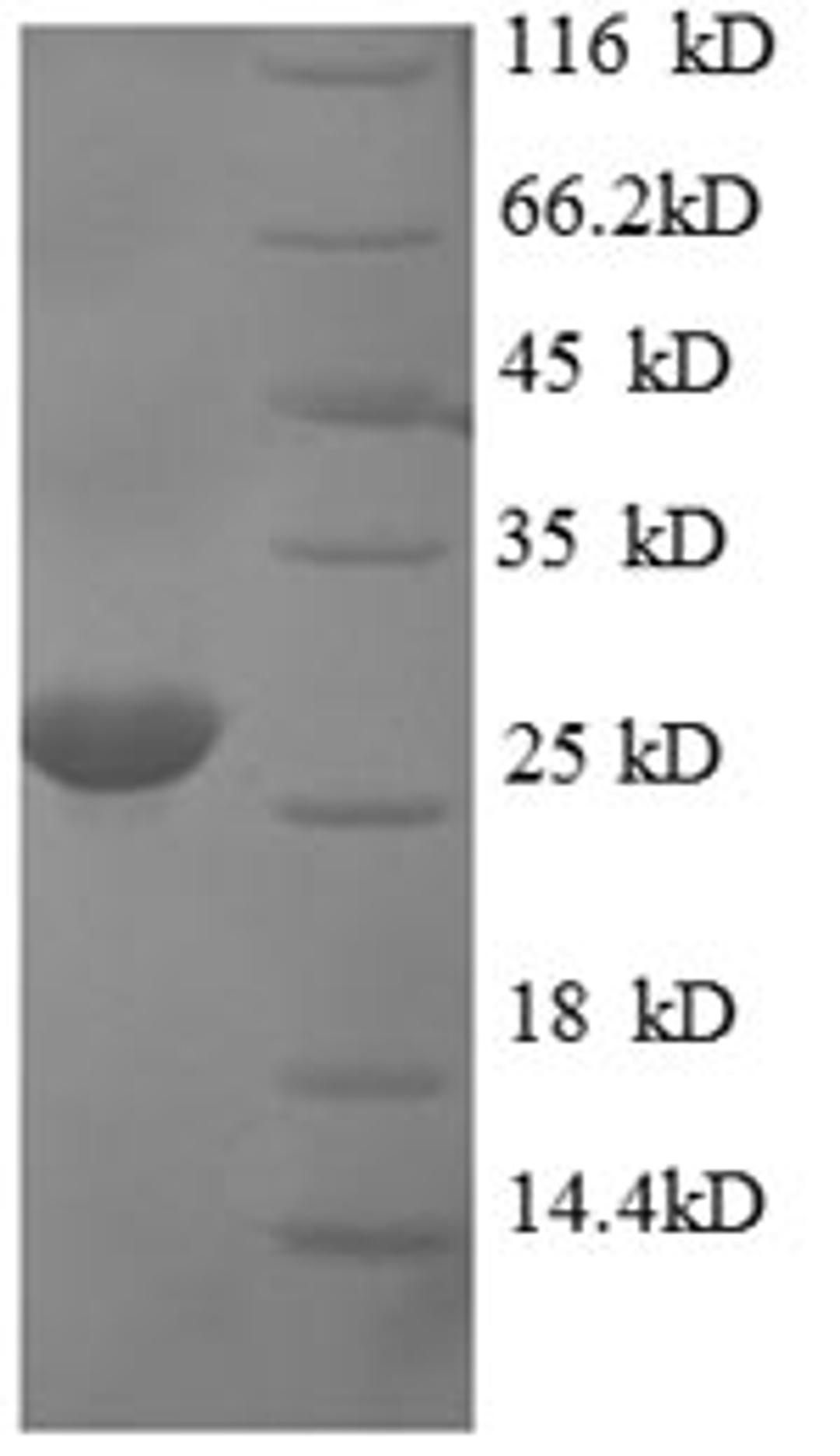 (Tris-Glycine gel) Discontinuous SDS-PAGE (reduced) with 5% enrichment gel and 15% separation gel.