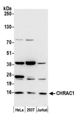 Detection of human CHRAC1 by western blot.