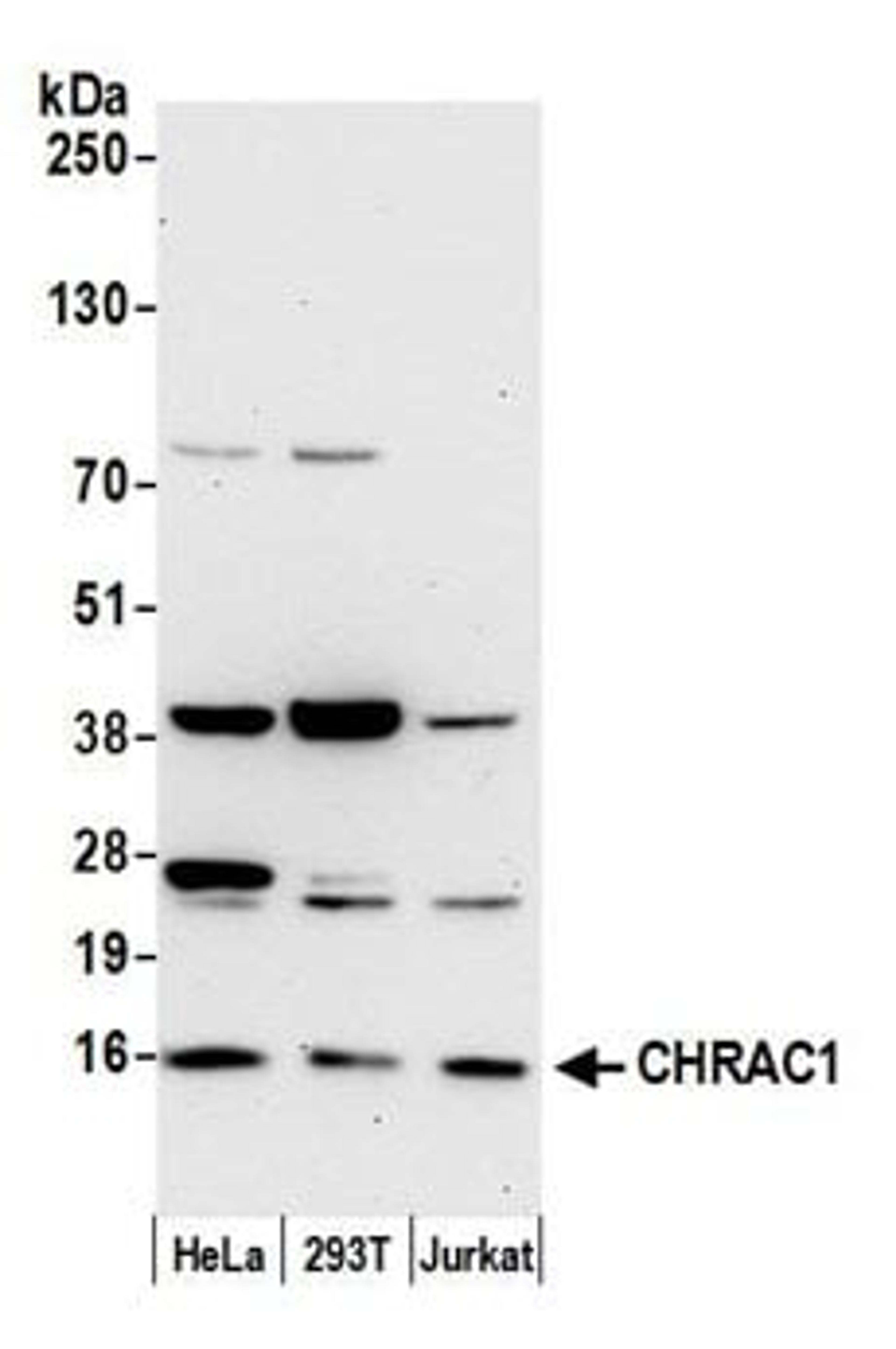 Detection of human CHRAC1 by western blot.