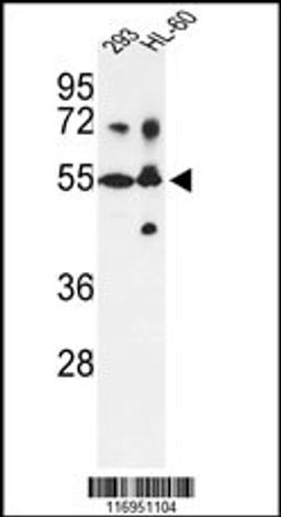 Western blot analysis of CYP21A2 Antibody in 293, HL-60 cell line lysates (35ug/lane)