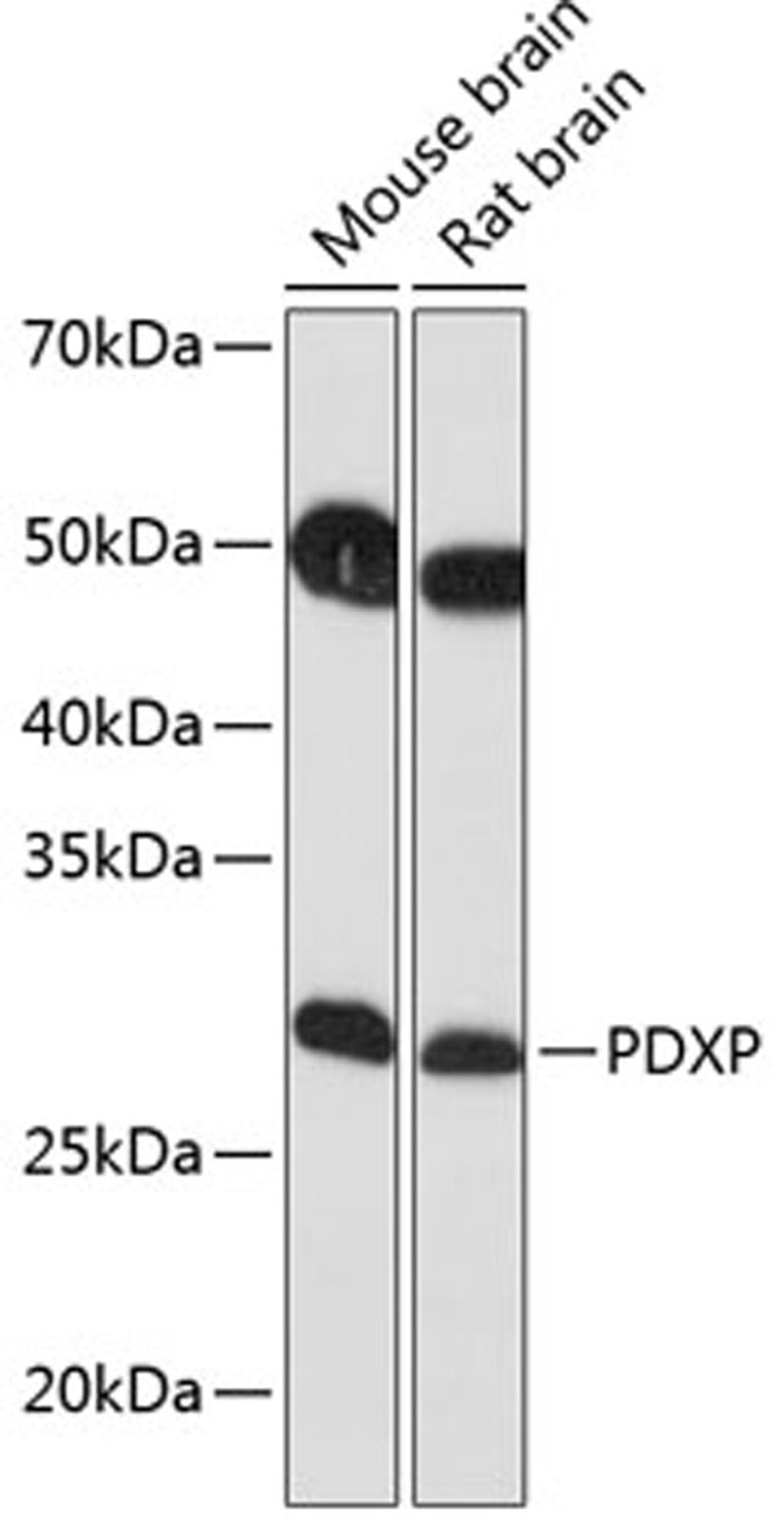 Western blot - PDXP Polyclonal Antibody (A17455)