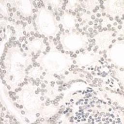 Detection of human ARID1B by immunohistochemistry.