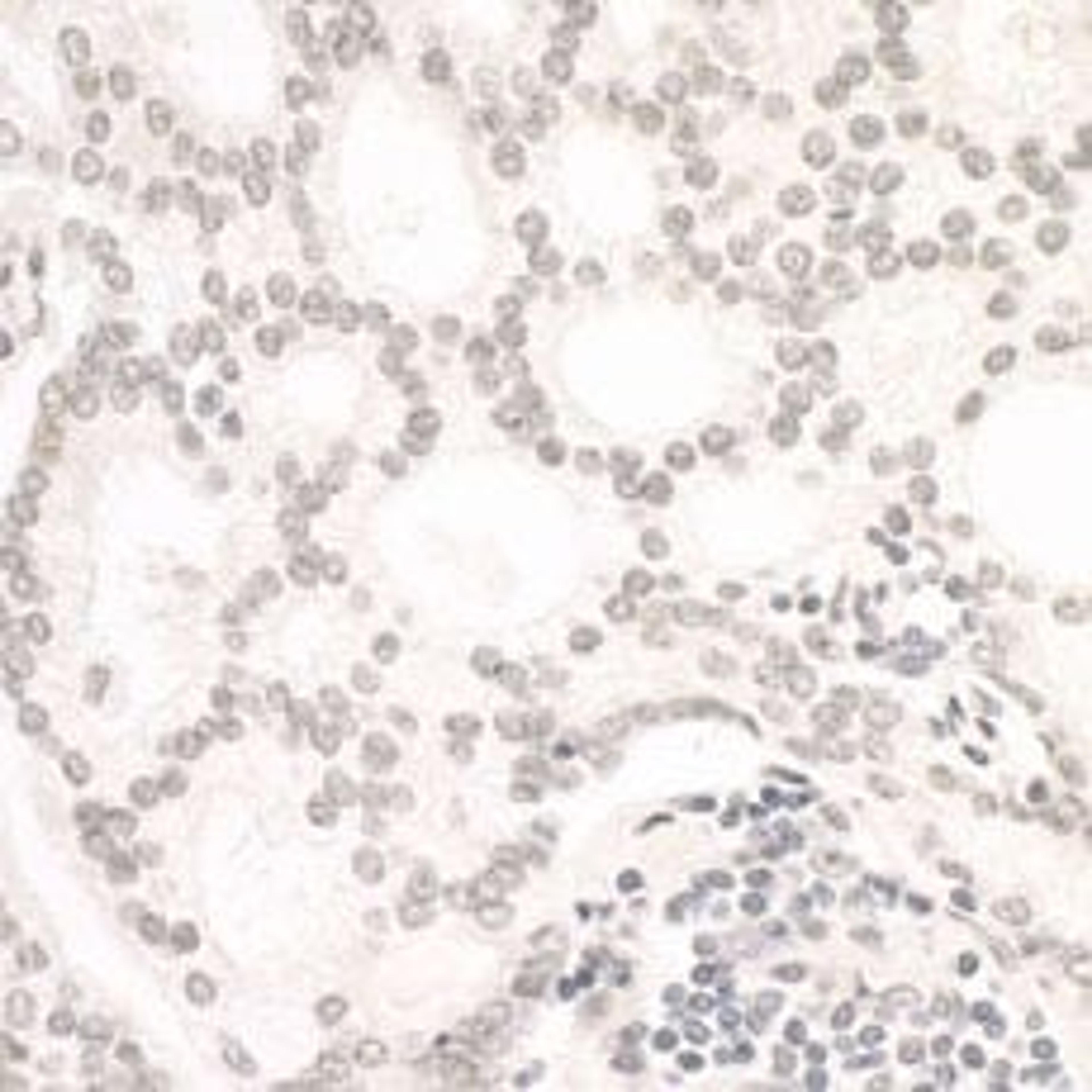 Detection of human ARID1B by immunohistochemistry.