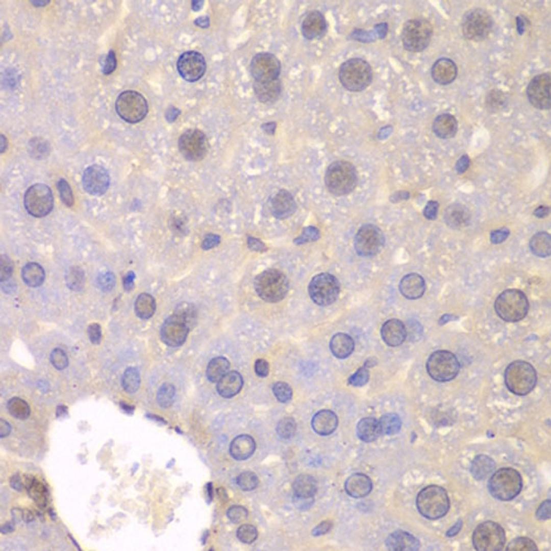 Immunohistochemistry  - FGFR1 antibody (A2073)