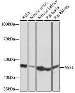 Western blot - ASS1 Rabbit mAb (A9084)