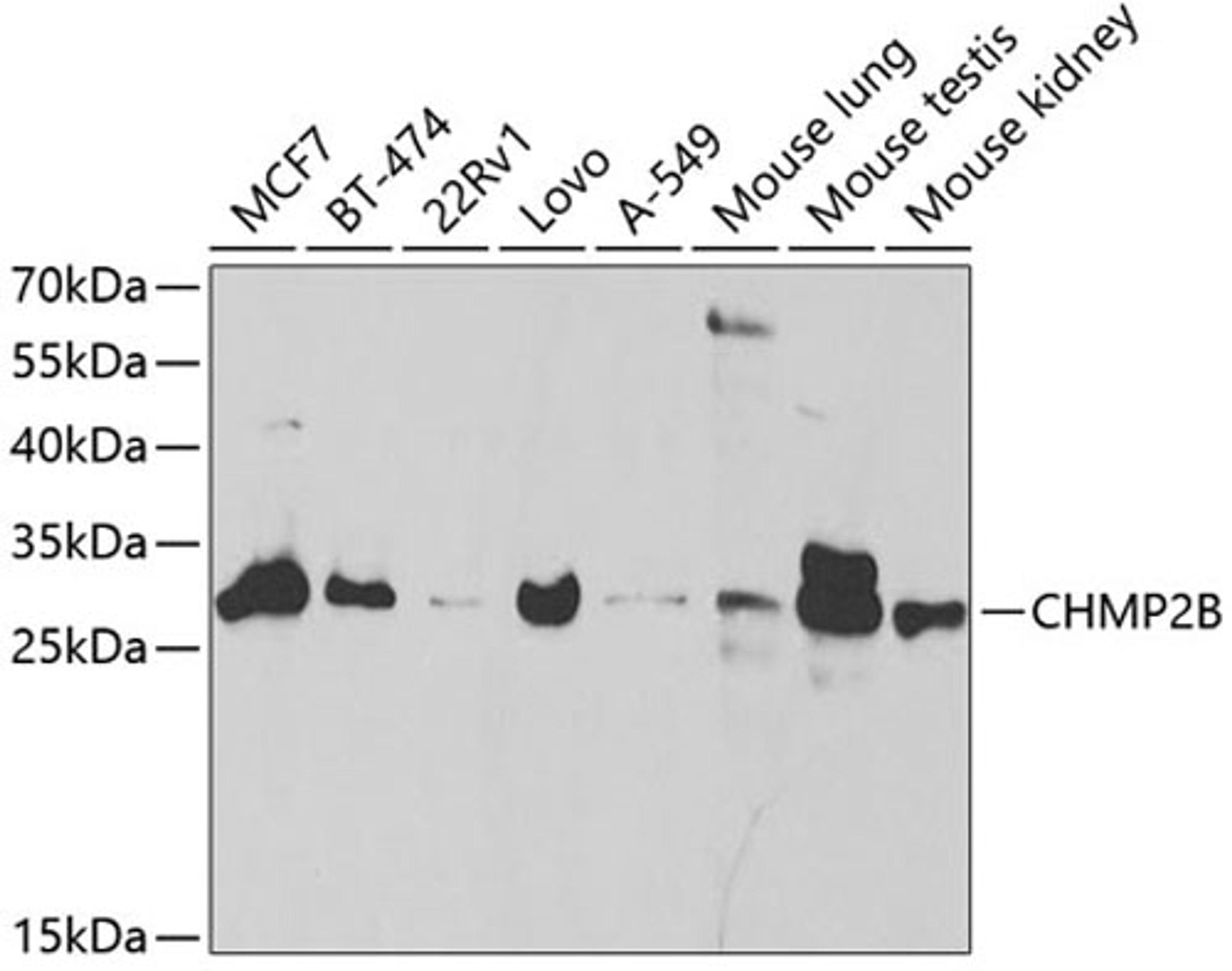 Western blot - CHMP2B antibody (A5399)