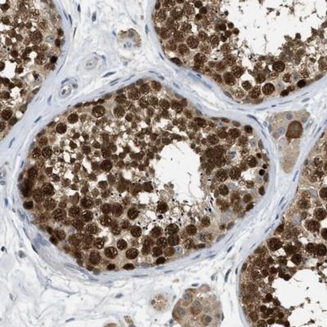 Immunohistochemistry: MIS18A Antibody [NBP1-88943] - Staining of human testis shows strong nuclear positivity in cells in seminiferus ducts. Sertoli cells are generally negative.