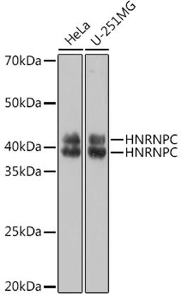 Western blot - HNRNPC Polyclonal Antibody (A19137)