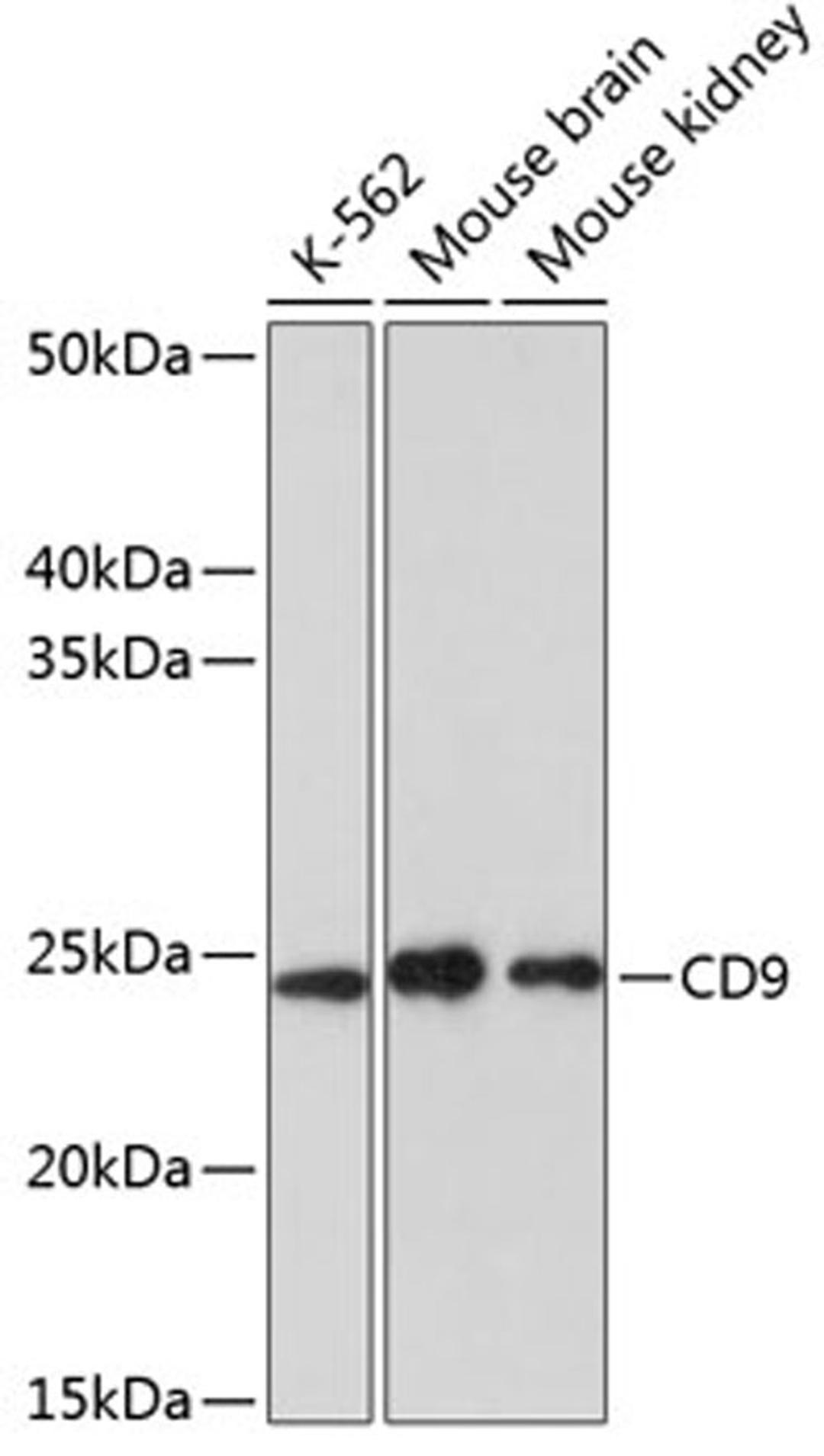 Western blot - CD9 antibody (A19027)