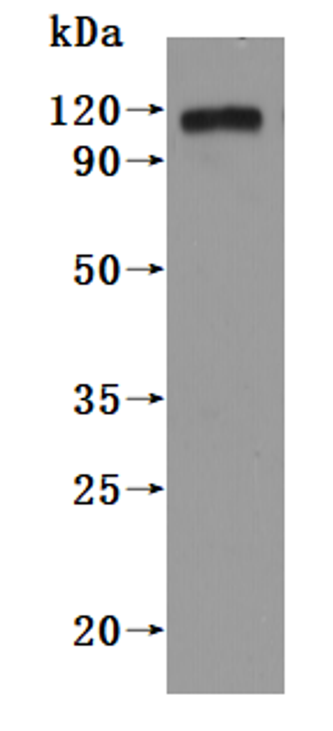 CSB-MP018751HU(A4) is detected by Mouse anti-6*His monoclonal antibody.