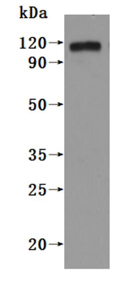 CSB-MP018751HU(A4) is detected by Mouse anti-6*His monoclonal antibody.