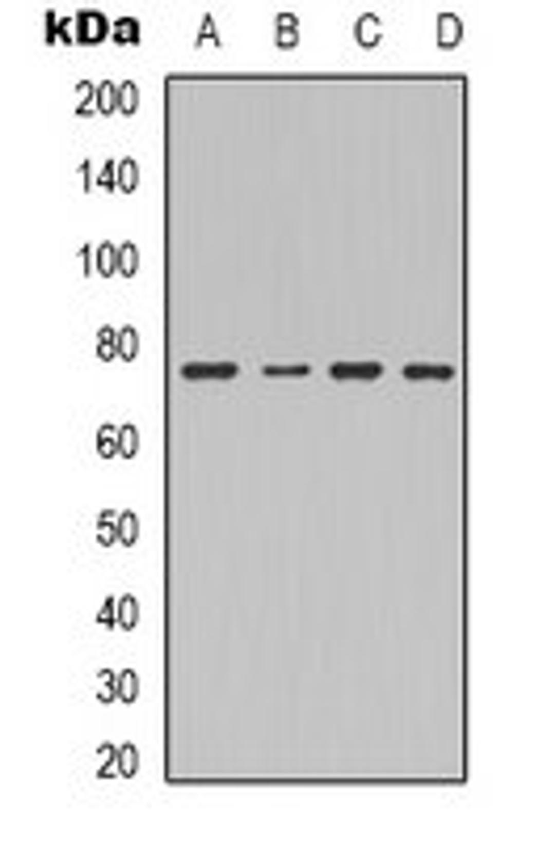 Western blot analysis of Hela (Lane 1), mouse kidney (Lane 2), mouse heart (Lane 3), mouse liver (Lane 4) whole cell lysates using Factor XIII B antibody