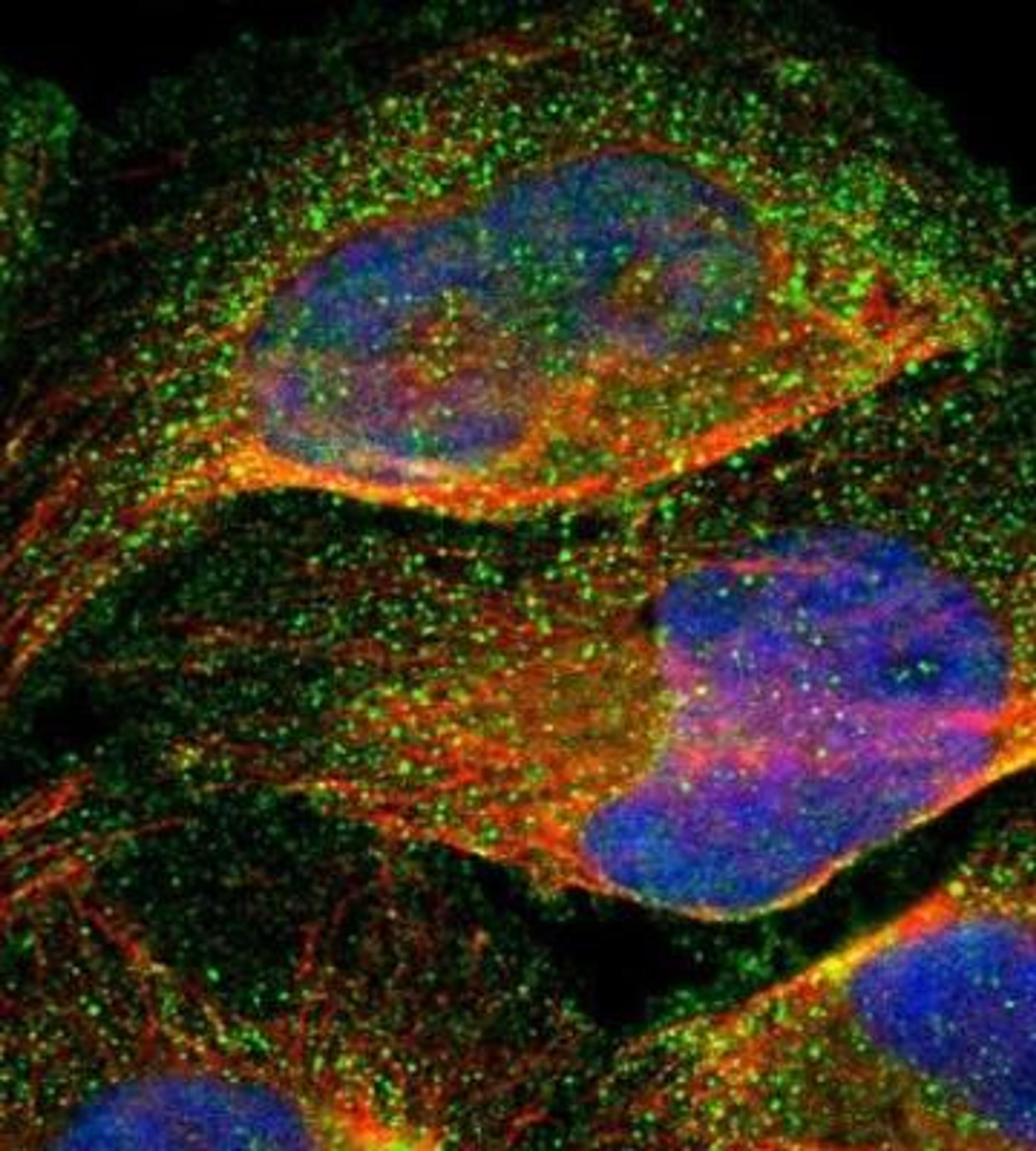 Immunocytochemistry/Immunofluorescence: ZNF10 Antibody [NBP1-81348] - Staining of human cell line U-2 OS shows positivity in plasma membrane & vesicles.