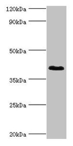 Western blot. All lanes: DHRS7 antibody at 2ug/ml + MCF-7 whole cell lysate. Secondary. Goat polyclonal to rabbit IgG at 1/10000 dilution. Predicted band size: 39, 33 kDa. Observed band size: 39 kDa. 