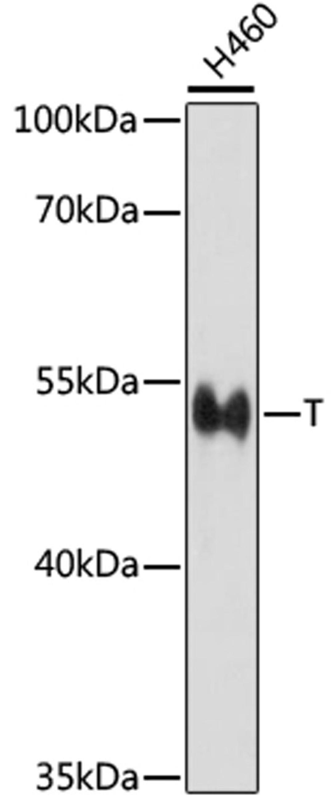 Western blot - T antibody (A16887)