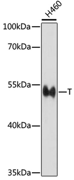 Western blot - T antibody (A16887)