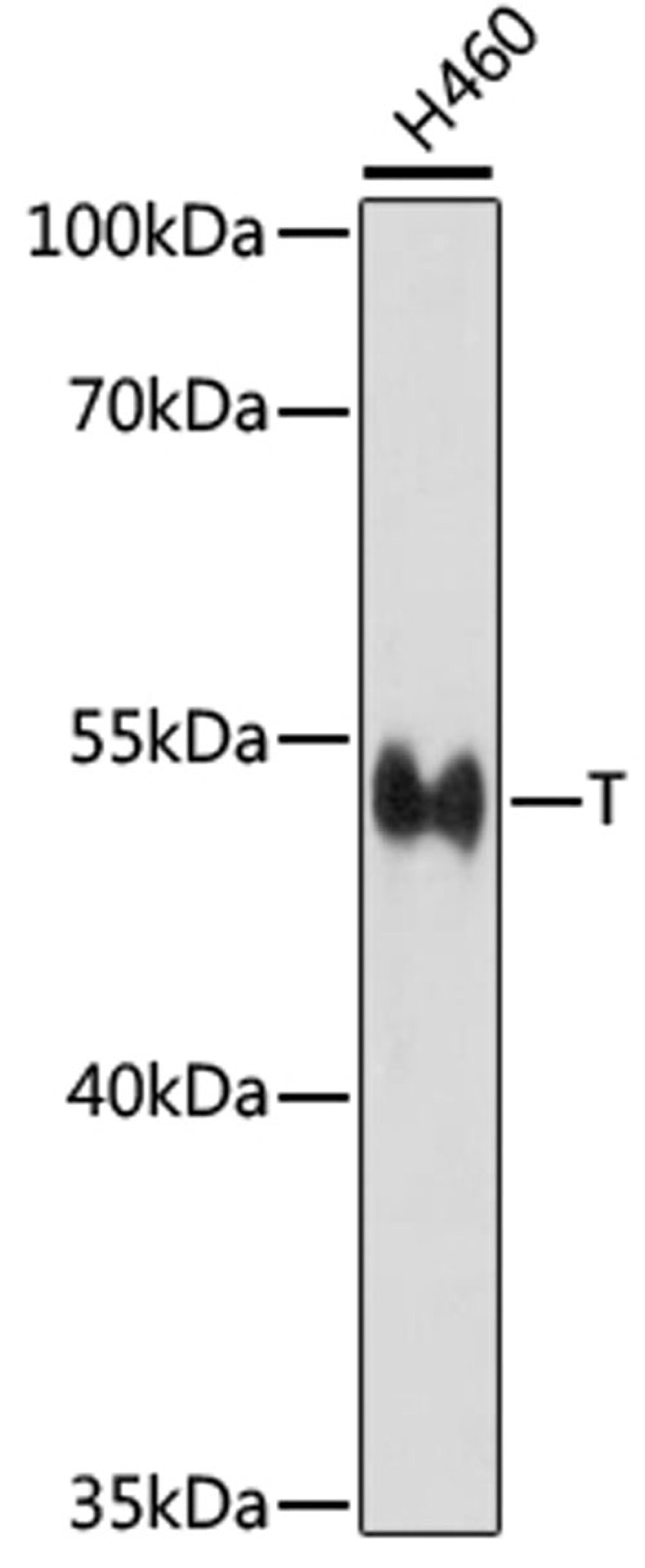 Western blot - T antibody (A16887)