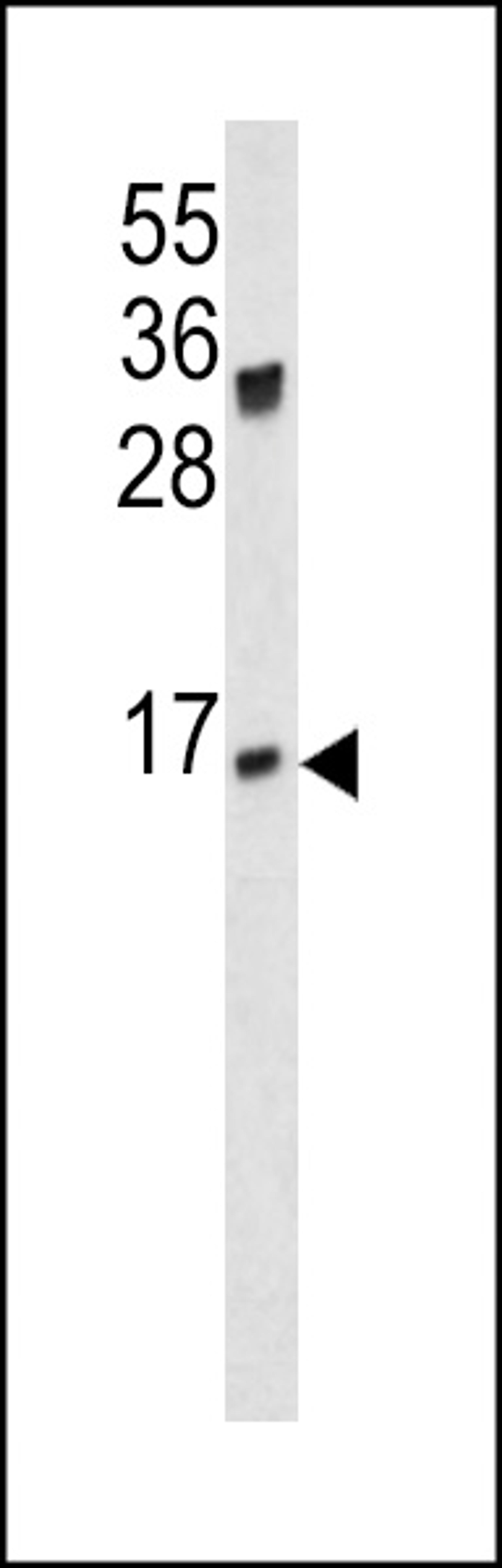 Western blot analysis of IGJ antibody in mouse spleen lysates (35ug/lane)