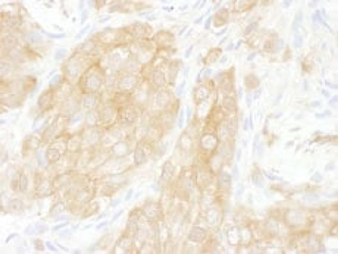 Detection of human 14-3-3-theta by immunohistochemistry.