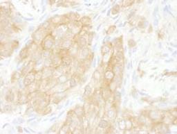 Detection of human 14-3-3-theta by immunohistochemistry.