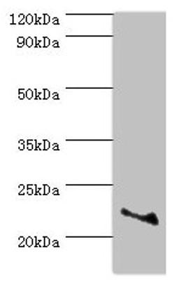 Western blot. All lanes: ASF1A antibody at 2µg/ml + Jurkat whole cell lysate. Secondary. Goat polyclonal to rabbit IgG at 1/10000 dilution. Predicted band size: 23 kDa. Observed band size: 23 kDa