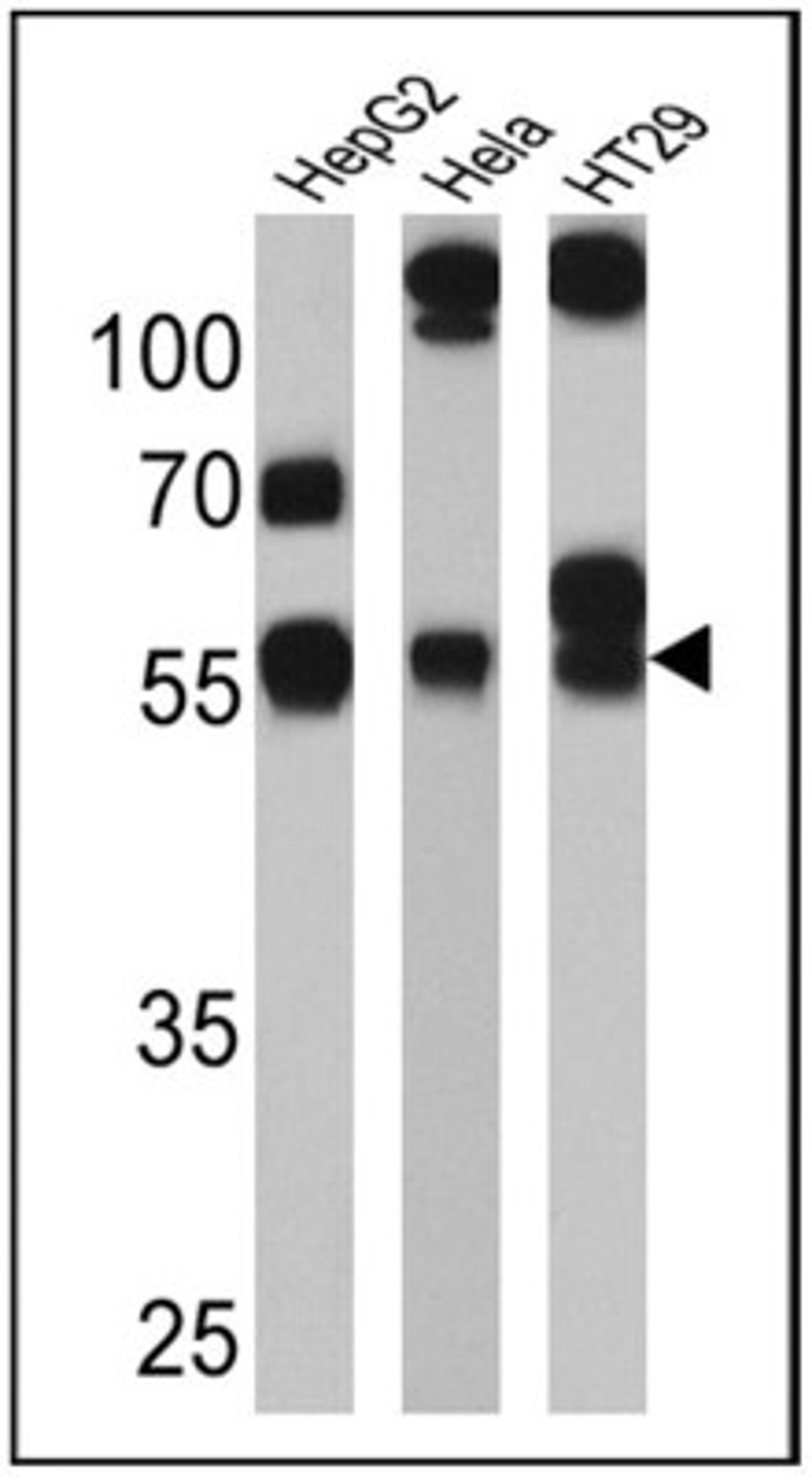 Western Blot: Cytochrome P450 3A7 Antibody (F19 P2 H2) [NB100-74402] - Analysis of 25 ug of HepG2 (lane 1), Hela (lane 2) and HT29 (lane 3) cell lysates.