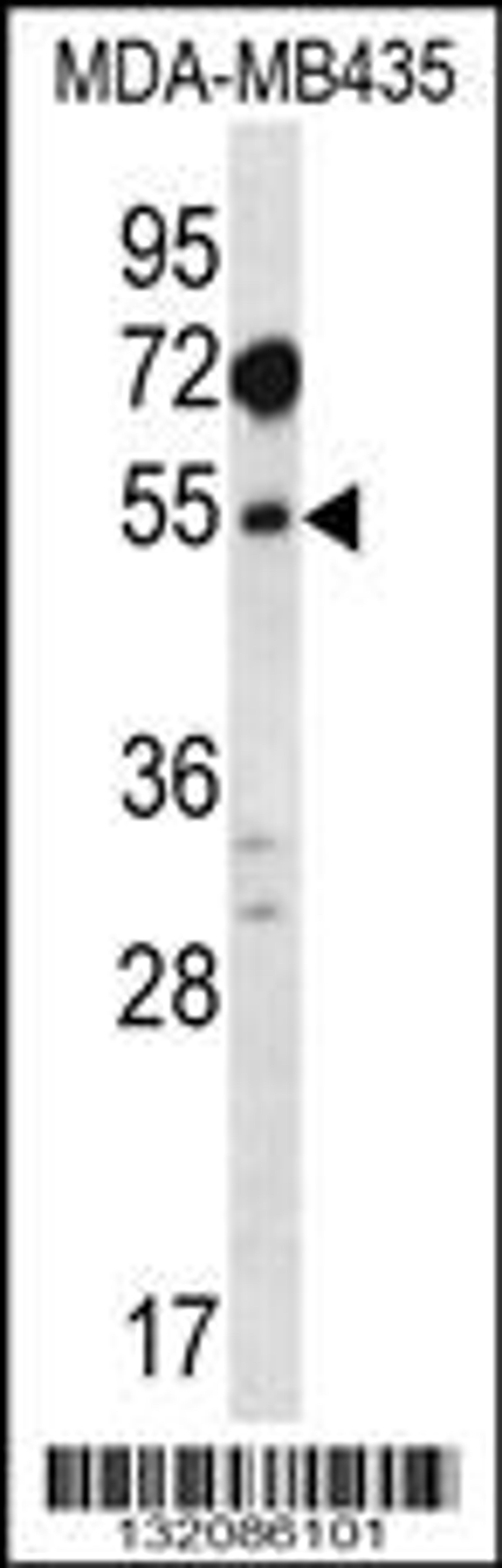 Western blot analysis in MDA-MB435 cell line lysates (35ug/lane).