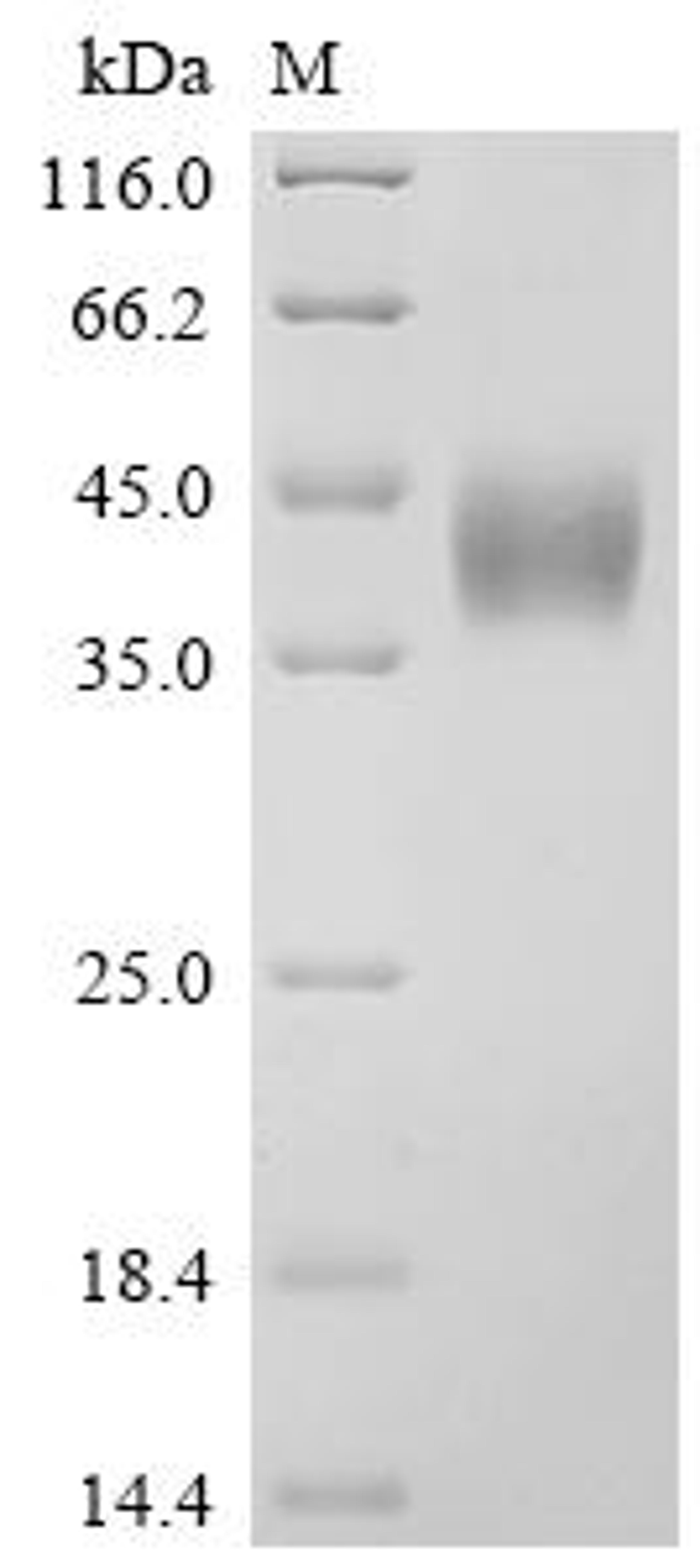(Tris-Glycine gel) Discontinuous SDS-PAGE (reduced) with 5% enrichment gel and 15% separation gel.