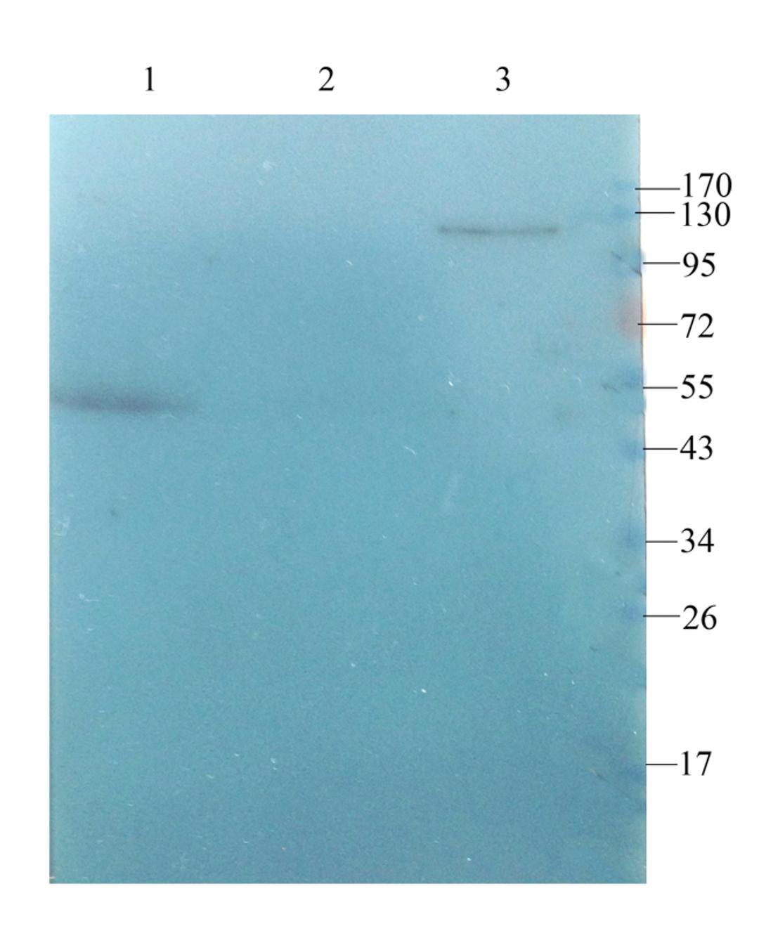 Western blot analysis of rat spleen (lane 1), rat pancreas (lane 2), mouse testis (lane 3) using Iduronate 2 sulfatase (1 ug/ml)