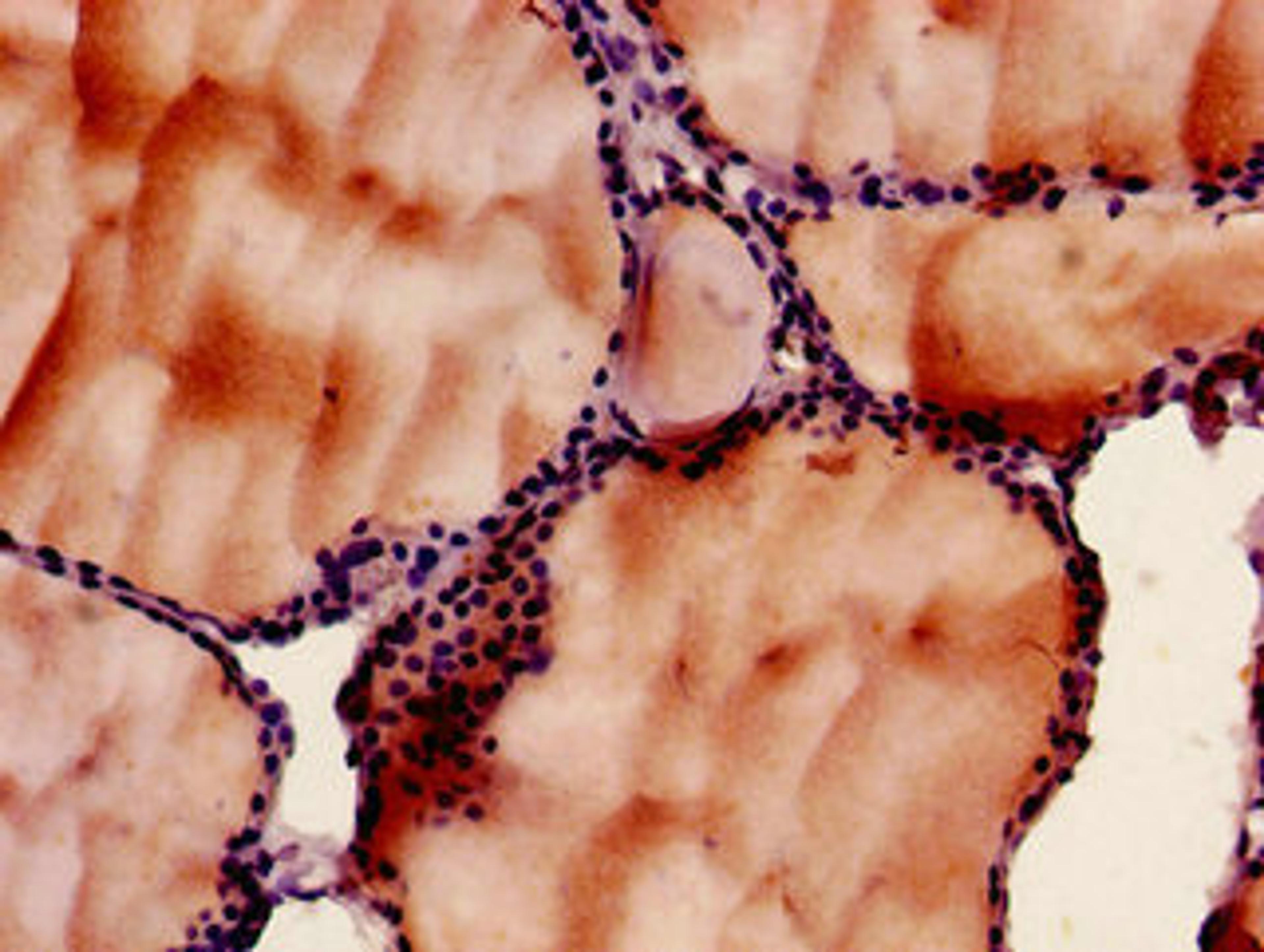 Immunohistochemistry of paraffin-embedded human thyroid tissue using CSB-PA13339A0Rb at dilution of 1:100